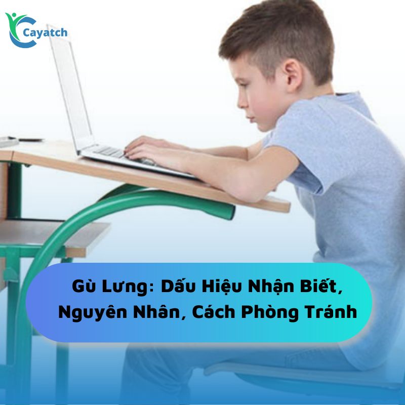 dấu hiệu bị gù lưng