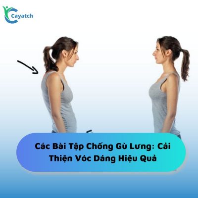 các bài tập chống gù lưng