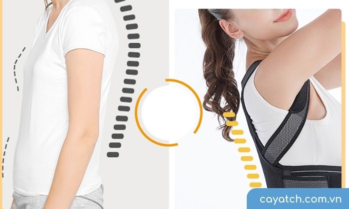 Đai chống gù lưng có tầm ảnh hướng lớn người người bị vấn đề xương sống