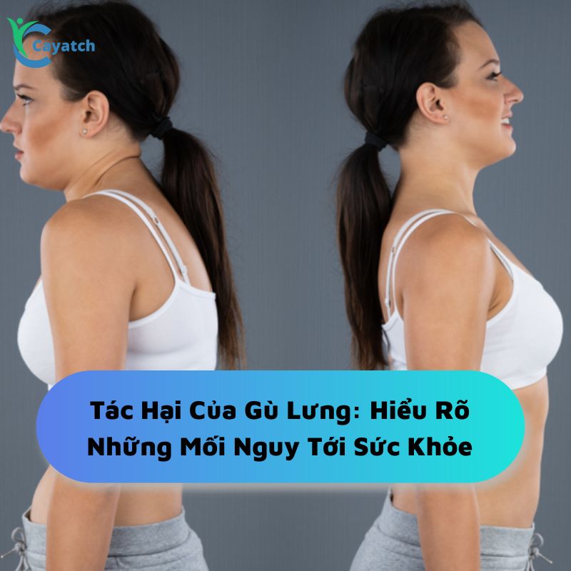 Tác hại của gù lưng