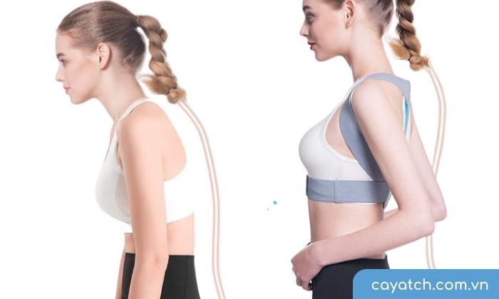 Vóc dáng trở nên đẹp hơn nhờ sử dụng đai chống gù lưng