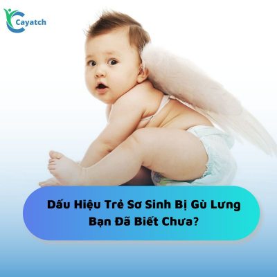 dấu hiệu trẻ sơ sinh bị gù lưng
